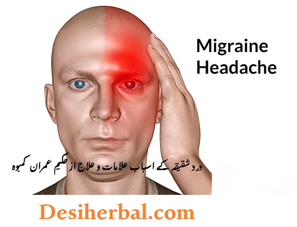 desiherbal.com-درد شقیقہ کیا ہے اسکے اسباب و علاج