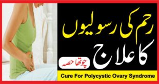 cure for Polycystic Ovary Syndrome : رحم کی رسولیوں کاعلاج چوتھا حصہ