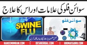 Swine Flu Symptoms And Treatment in Urdu& Hindi