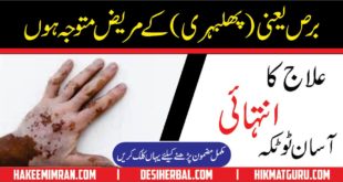 Leucoderma ( Vitiligo ) ( phulbehri ) Treatment In Urdu By Hakeem imran Kamboh (2)