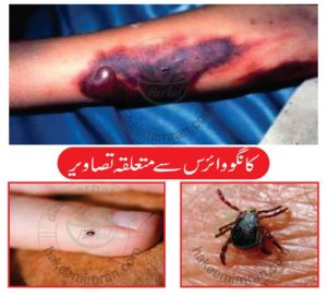 What is The Congo Virus and How Can it Affect You In Pakistan (6)