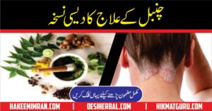 chambal-ka-ilaj-psoriasis-causes-treatment-in-urdu-2